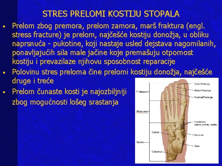 STRES PRELOMI KOSTIJU STOPALA Prelom zbog premora, prelom zamora, marš fraktura (engl. stress fracture)