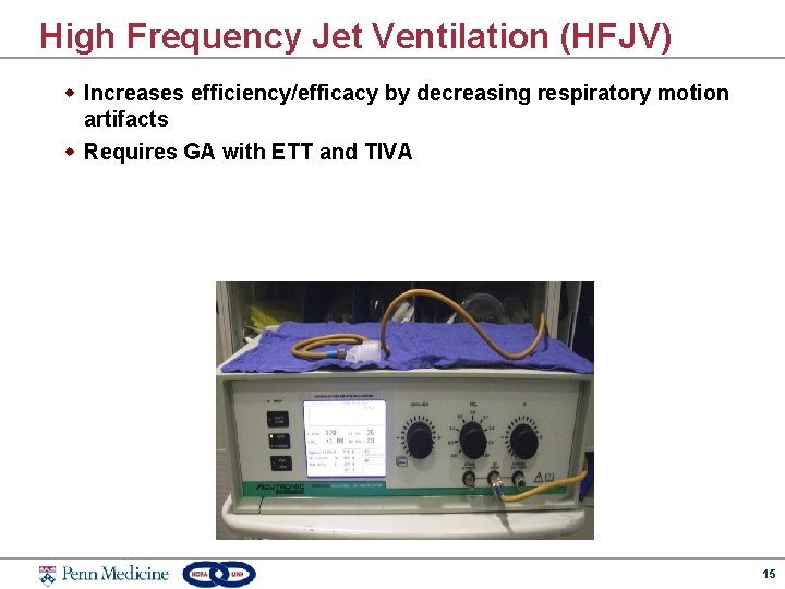 High Frequency Jet Ventilation (HFJV) w Increases efficiency/efficacy by decreasing respiratory motion artifacts w