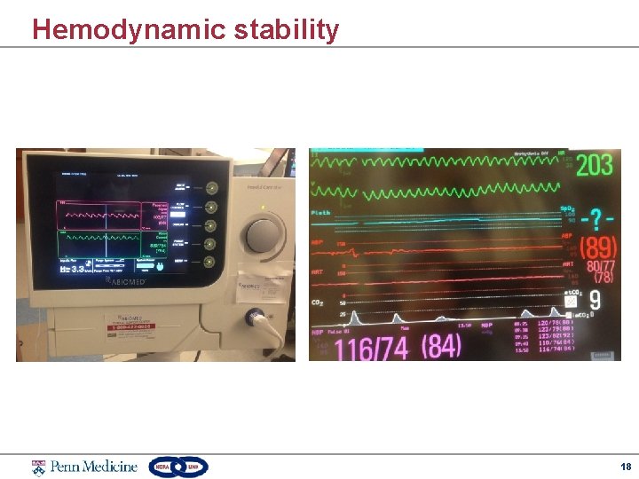 Hemodynamic stability 18 