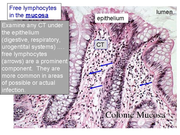 Free lymphocytes in the mucosa Examine any CT under the epithelium (digestive, respiratory, urogentital