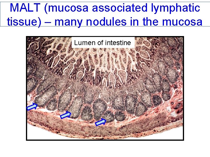 MALT (mucosa associated lymphatic tissue) – many nodules in the mucosa Lumen of intestine