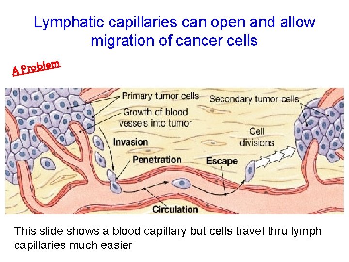 Lymphatic capillaries can open and allow migration of cancer cells lem b o r