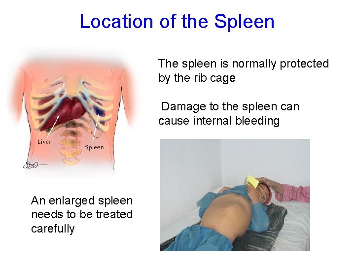 Location of the Spleen The spleen is normally protected by the rib cage Damage