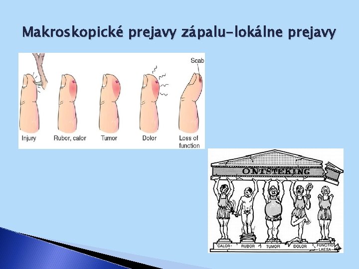 Makroskopické prejavy zápalu-lokálne prejavy 