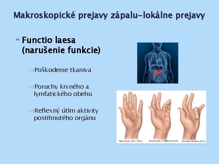 Makroskopické prejavy zápalu-lokálne prejavy Functio laesa (narušenie funkcie) Poškodenie tkaniva Poruchy krvného a lymfatického