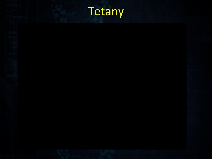 Tetany 