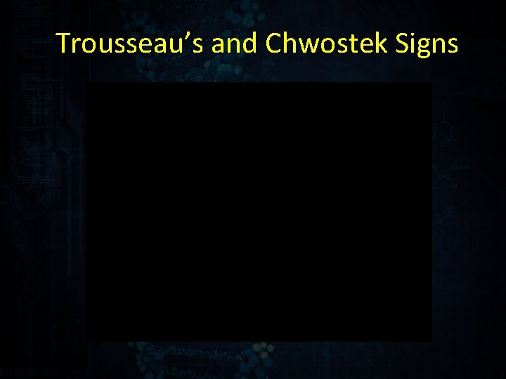 Trousseau’s and Chwostek Signs 