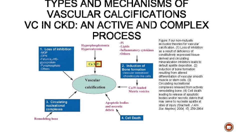 Figure: Four non-mutually exclusive theories for vascular calcification. (1) Loss of inhibition as a