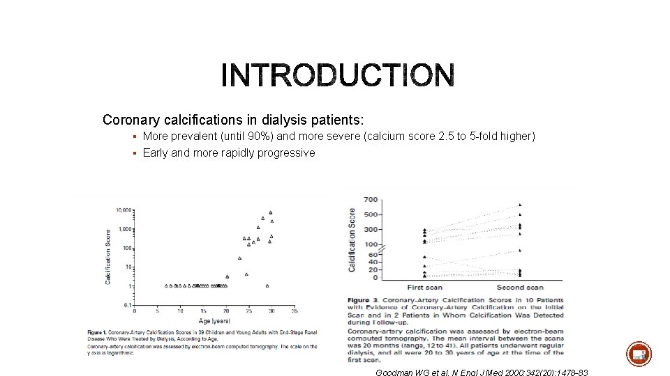 Coronary calcifications in dialysis patients: § More prevalent (until 90%) and more severe (calcium