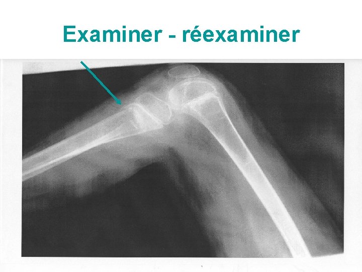 Examiner - réexaminer 42 