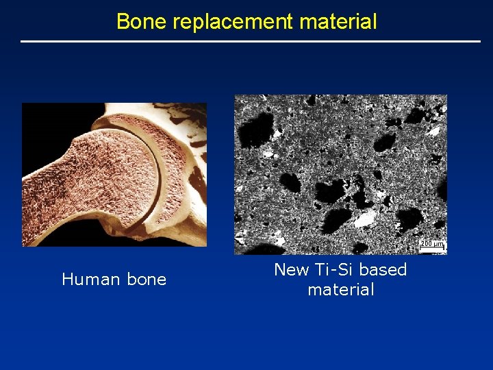 Bone replacement material Human bone New Ti-Si based material 