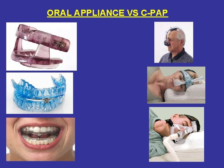 ORAL APPLIANCE VS C-PAP 