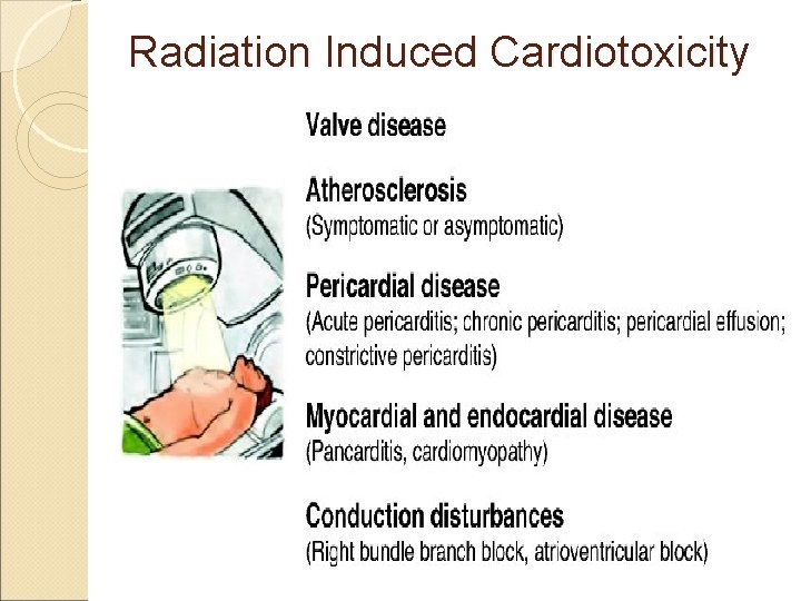 Radiation Induced Cardiotoxicity 