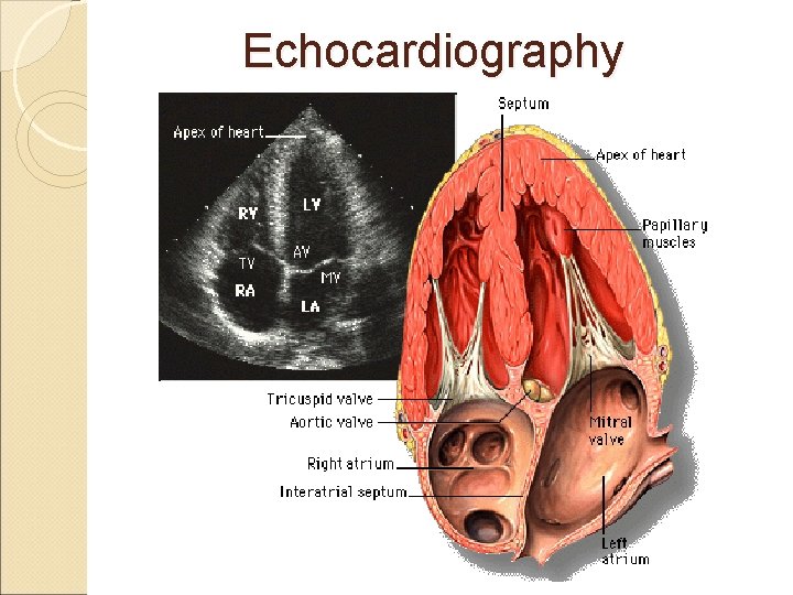  Echocardiography 