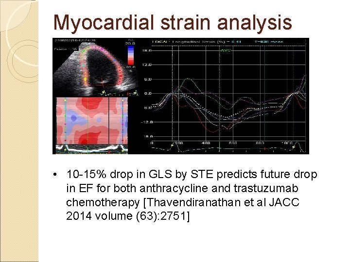 Myocardial strain analysis • 10 -15% drop in GLS by STE predicts future drop