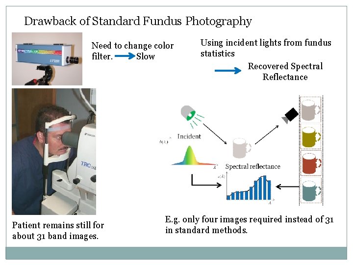 Drawback of Standard Fundus Photography Need to change color filter. Slow Patient remains still Drawback of Standard Fundus Photography Need to change color filter. Slow Patient remains still