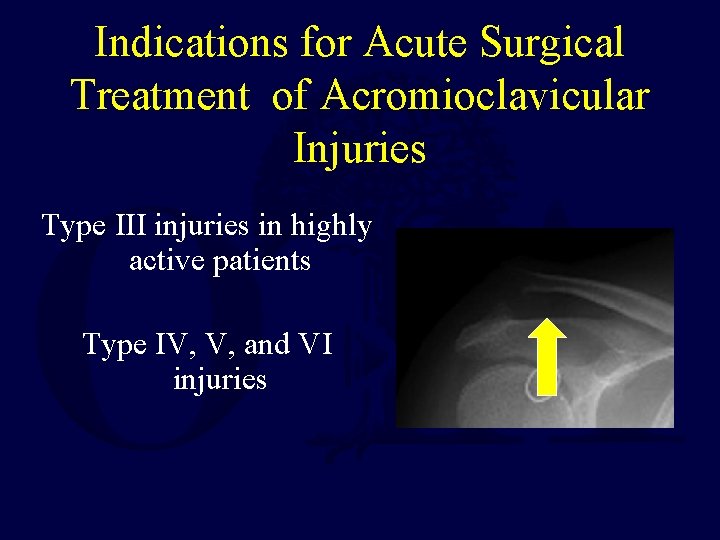 Indications for Acute Surgical Treatment of Acromioclavicular Injuries Type III injuries in highly active