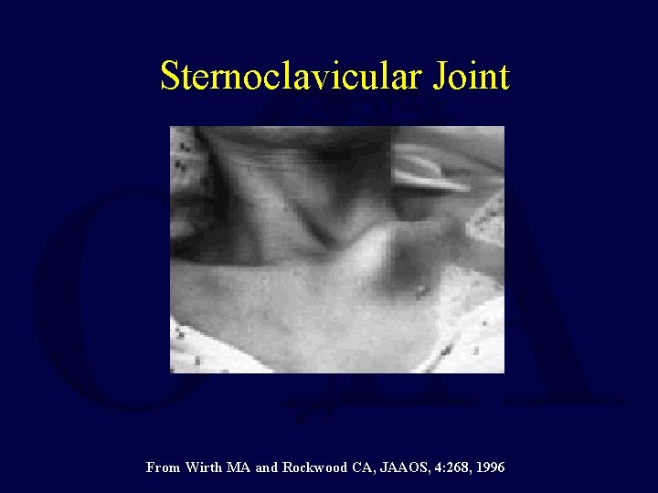 Sternoclavicular Joint From Wirth MA and Rockwood CA, JAAOS, 4: 268, 1996 