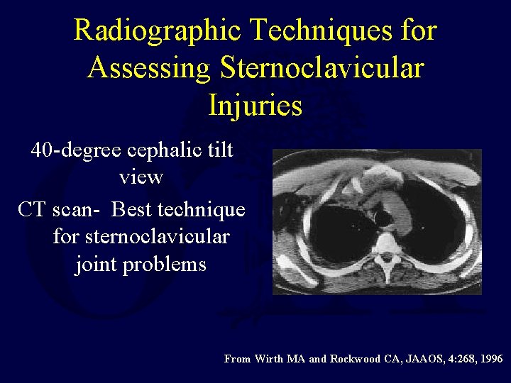 Radiographic Techniques for Assessing Sternoclavicular Injuries 40 -degree cephalic tilt view CT scan- Best