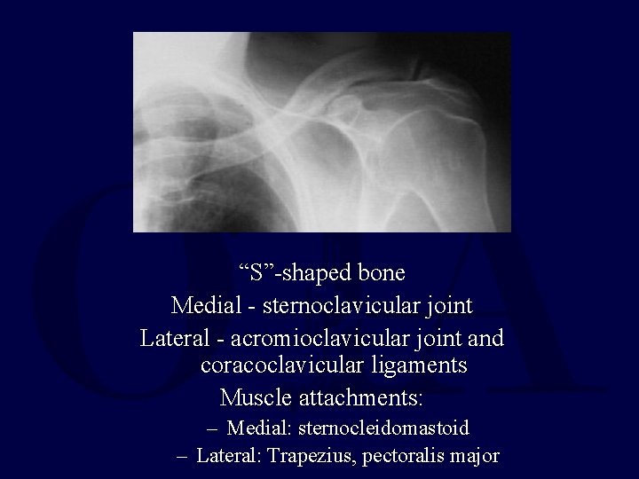 Clavicle “S”-shaped bone Medial - sternoclavicular joint Lateral - acromioclavicular joint and coracoclavicular ligaments