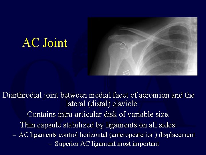 AC Joint Diarthrodial joint between medial facet of acromion and the lateral (distal) clavicle.