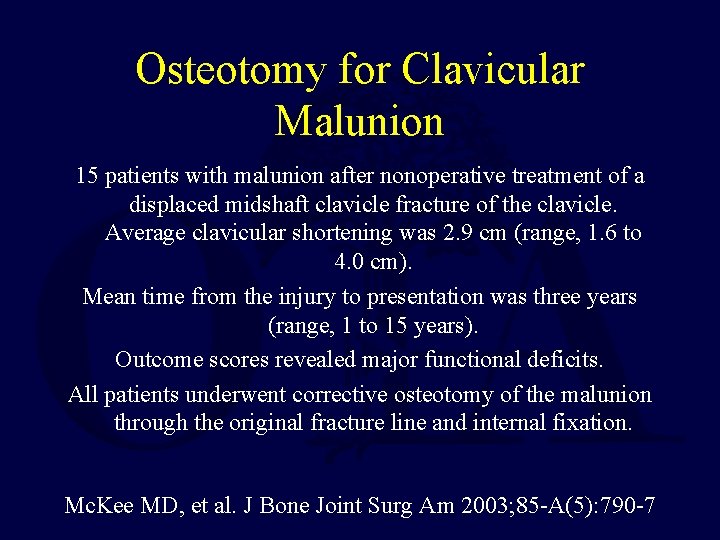 Osteotomy for Clavicular Malunion 15 patients with malunion after nonoperative treatment of a displaced