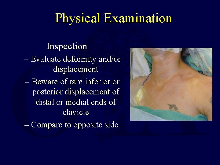 Physical Examination Inspection – Evaluate deformity and/or displacement – Beware of rare inferior or