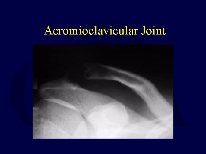 Acromioclavicular Joint 
