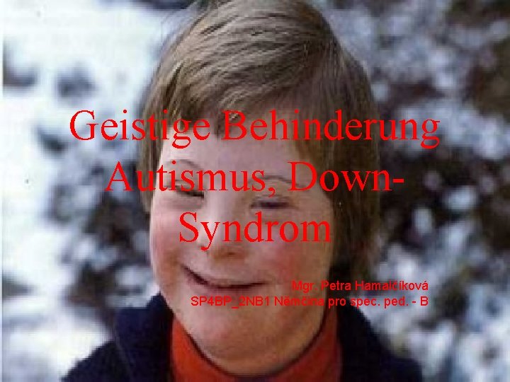 Geistige Behinderung Autismus, Down. Syndrom Mgr. Petra Hamalčíková SP 4 BP_2 NB 1 Němčina