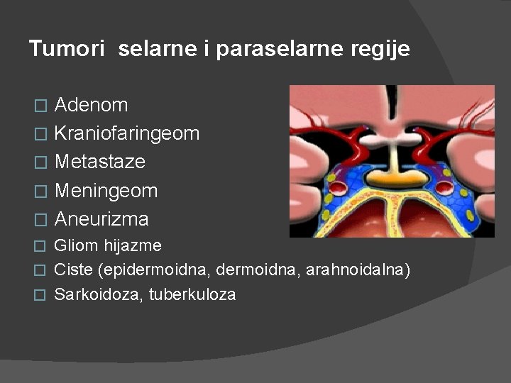 Tumori selarne i paraselarne regije Adenom � Kraniofaringeom � Metastaze � Meningeom � Aneurizma Tumori selarne i paraselarne regije Adenom � Kraniofaringeom � Metastaze � Meningeom � Aneurizma