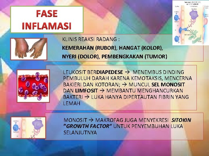 FASE INFLAMASI KLINIS REAKSI RADANG : KEMERAHAN (RUBOR), HANGAT (KOLOR), NYERI (DOLOR), PEMBENGKAKAN (TUMOR)