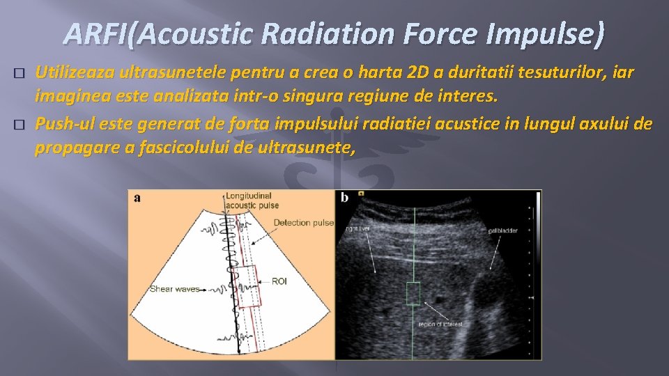 ARFI(Acoustic Radiation Force Impulse) � � Utilizeaza ultrasunetele pentru a crea o harta 2