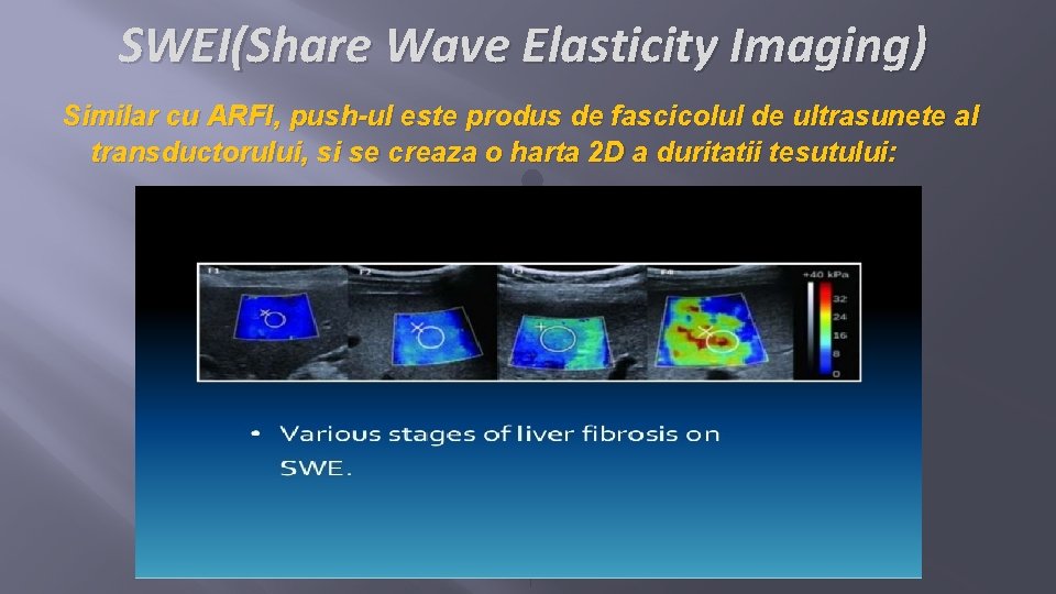 SWEI(Share Wave Elasticity Imaging) Similar cu ARFI, push-ul este produs de fascicolul de ultrasunete