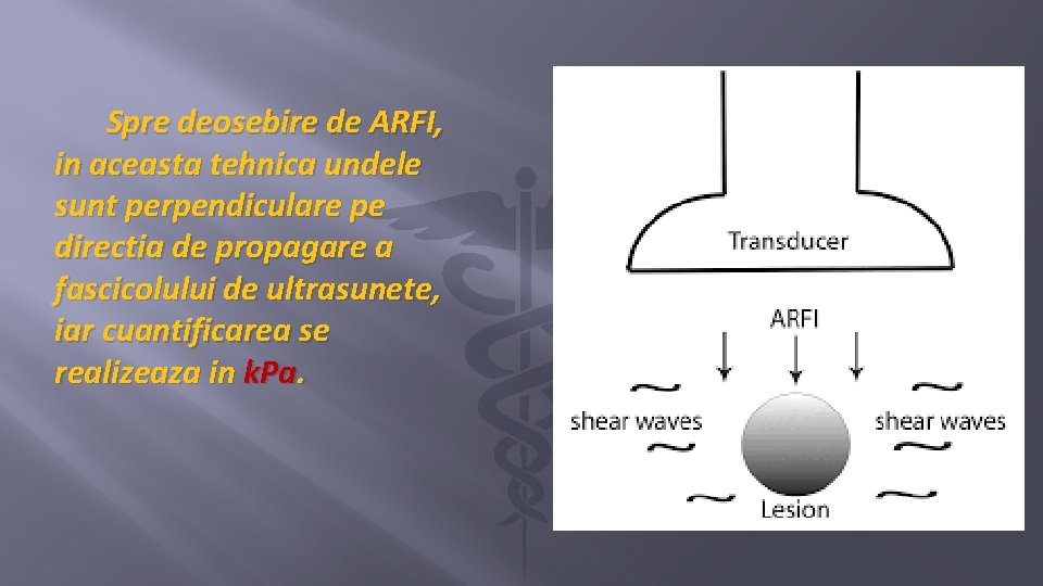 Spre deosebire de ARFI, in aceasta tehnica undele sunt perpendiculare pe directia de propagare