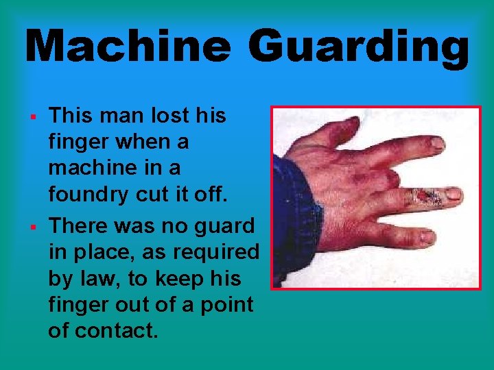 Machine Guarding § § This man lost his finger when a machine in a