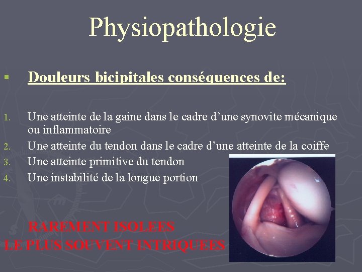 Physiopathologie § Douleurs bicipitales conséquences de: 1. Une atteinte de la gaine dans le