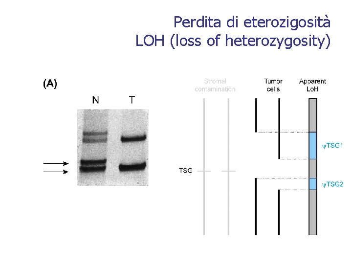 Perdita di eterozigosità LOH (loss of heterozygosity) 