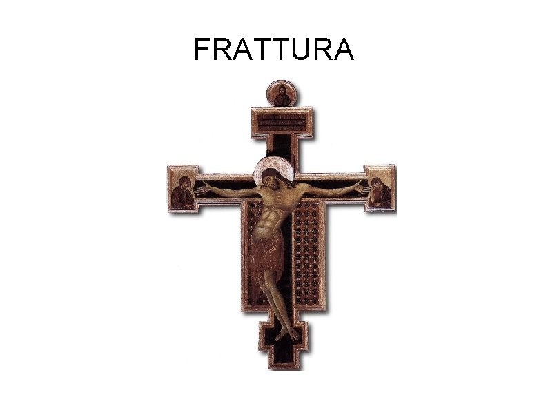 FRATTURA 