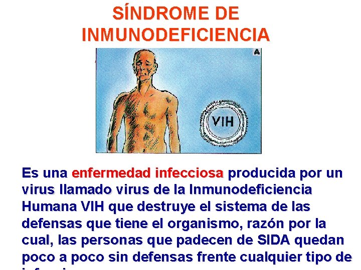 SÍNDROME DE INMUNODEFICIENCIA ADQUIRIDA (SIDA) Es una enfermedad infecciosa producida por un virus llamado
