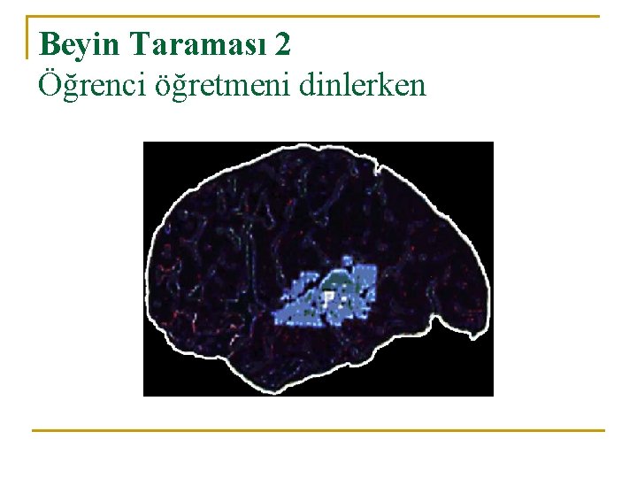 Beyin Taraması 2 Öğrenci öğretmeni dinlerken 