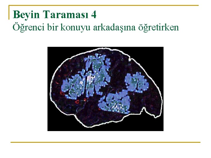 Beyin Taraması 4 Öğrenci bir konuyu arkadaşına öğretirken 