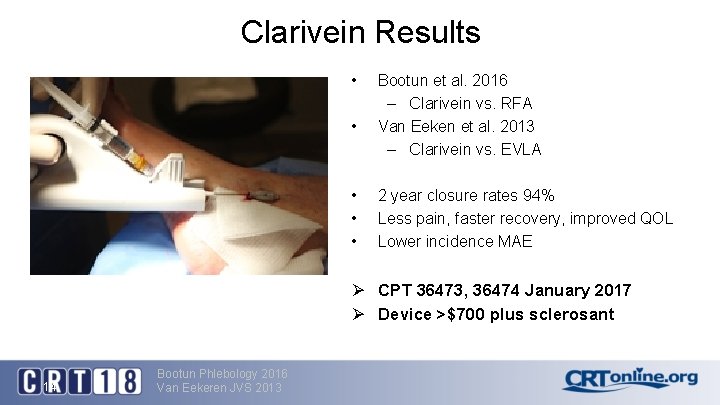 Clarivein Results • • • Bootun et al. 2016 – Clarivein vs. RFA Van