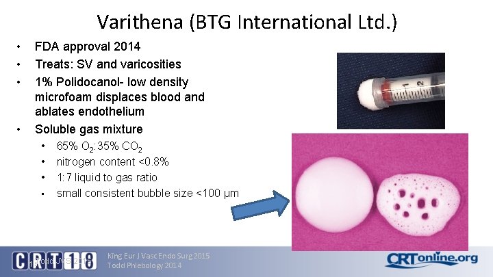 Varithena (BTG International Ltd. ) • • FDA approval 2014 Treats: SV and varicosities