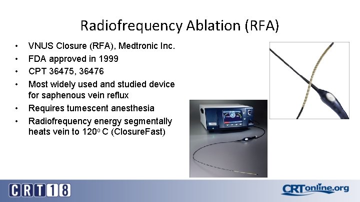 Radiofrequency Ablation (RFA) • • • VNUS Closure (RFA), Medtronic Inc. FDA approved in