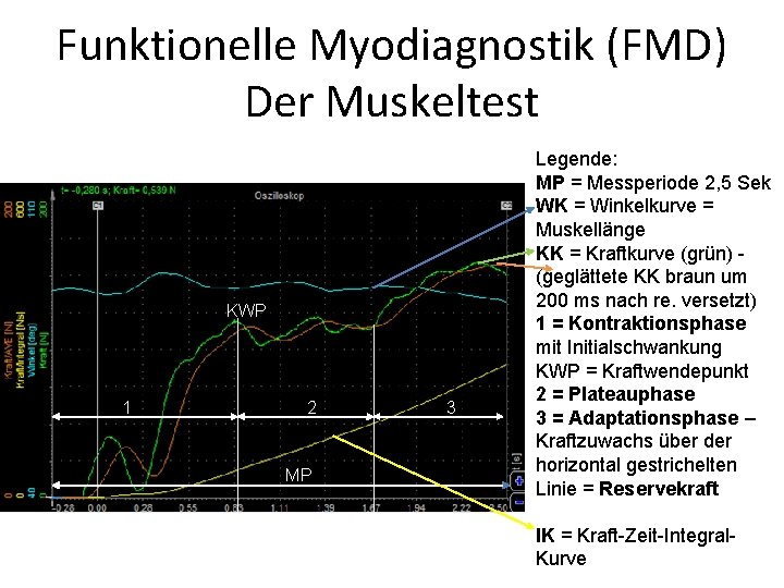 Funktionelle Myodiagnostik (FMD) Der Muskeltest KWP 1 2 MP 3 Legende: MP = Messperiode