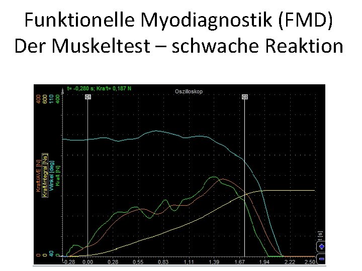 Funktionelle Myodiagnostik (FMD) Der Muskeltest – schwache Reaktion 