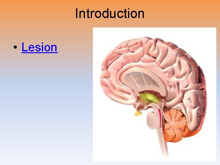 Introduction • Lesion 