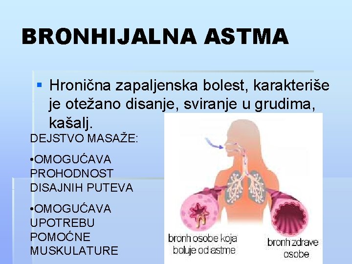 BRONHIJALNA ASTMA § Hronična zapaljenska bolest, karakteriše je otežano disanje, sviranje u grudima, kašalj.
