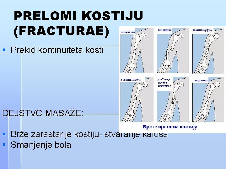 PRELOMI KOSTIJU (FRACTURAE) § Prekid kontinuiteta kosti DEJSTVO MASAŽE: § Brže zarastanje kostiju- stvaranje