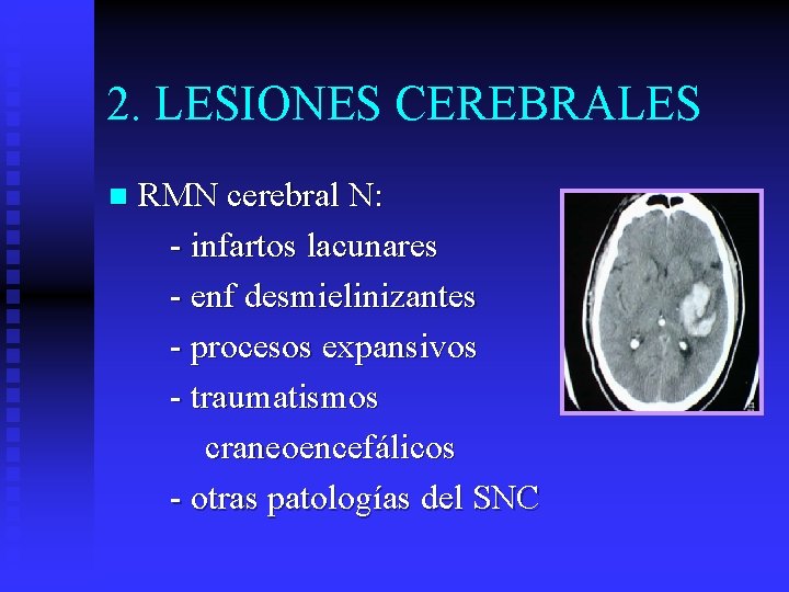 2. LESIONES CEREBRALES n RMN cerebral N: - infartos lacunares - enf desmielinizantes -